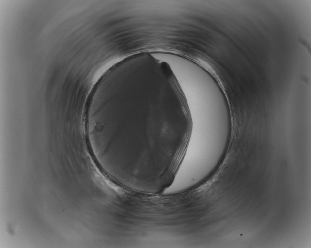 X0000099411141200806060925