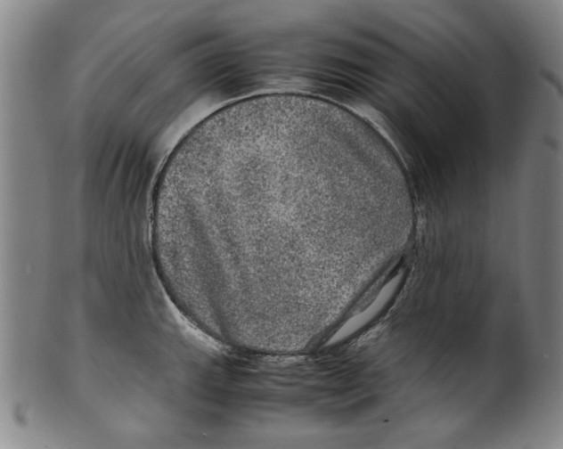 X0000099411143200806060925