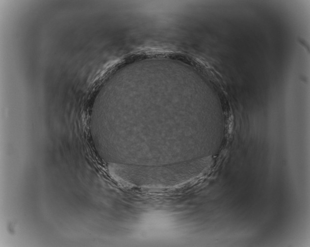 X0000099411157200806060925