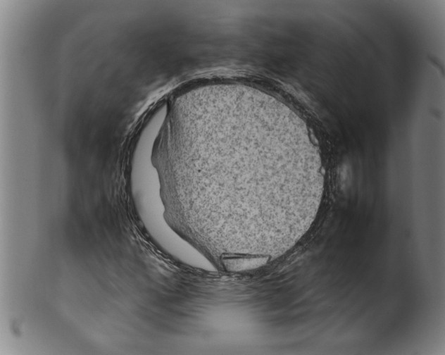 X0000099411160200806060925