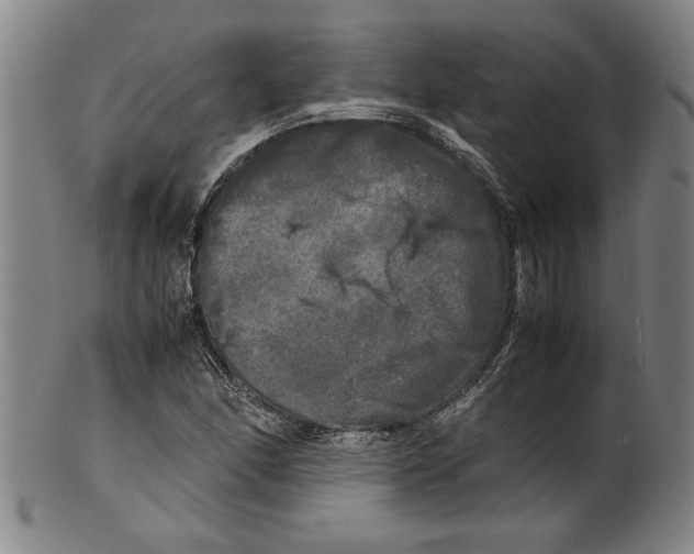 X0000099411166200806060925