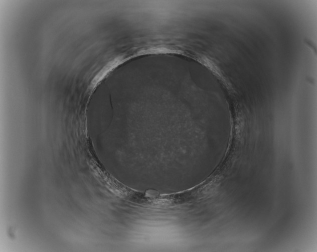 X0000099411173200806060924