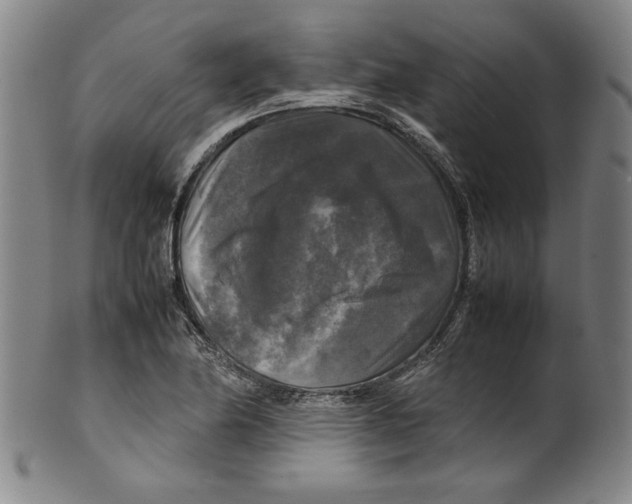 X0000099411174200806060924