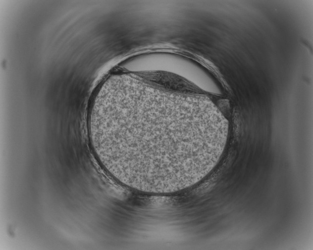 X0000099411176200806060924