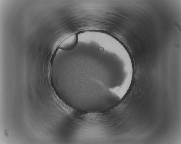 X0000099411179200806060924