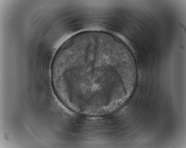 X0000099411335200806060922