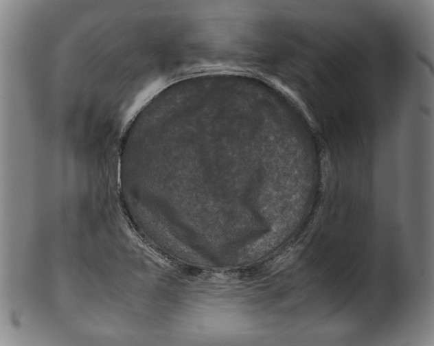 X0000099411365200806060921