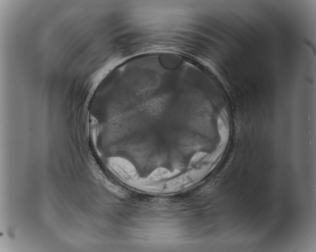 X0000099411371200806060921