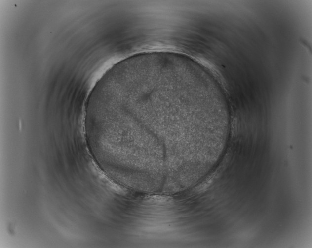 X0000099411374200806060921