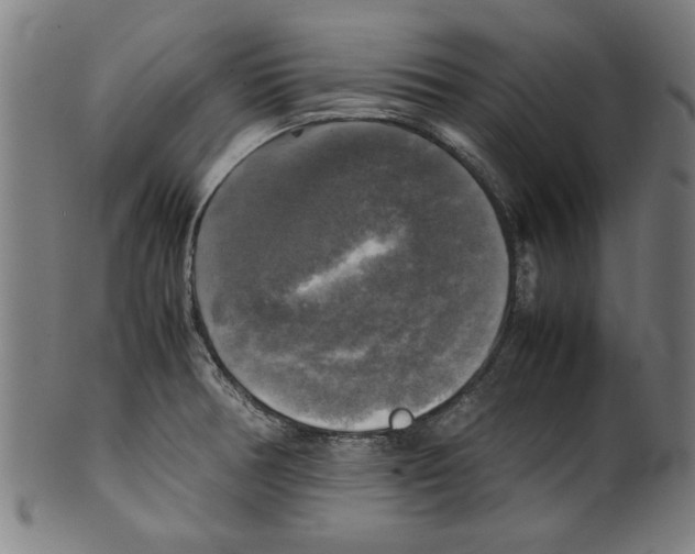 X0000099411378200806060921