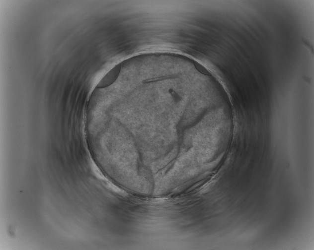 X0000099411390200806060921