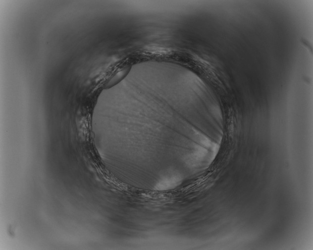 X0000099411397200806060920