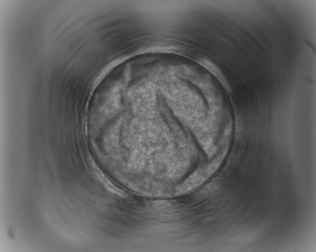 X0000099411436200806060921