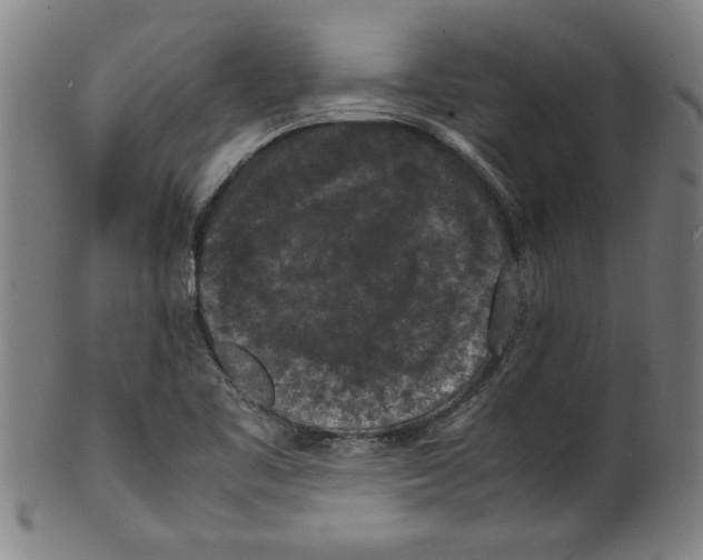 X0000099411461200806060920