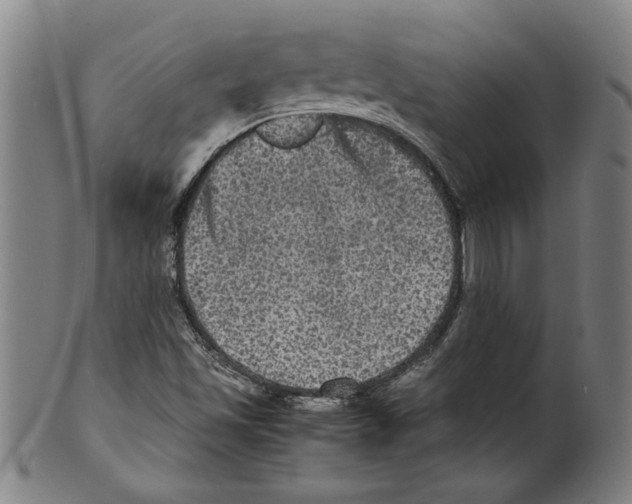 X0000099411501200806060919