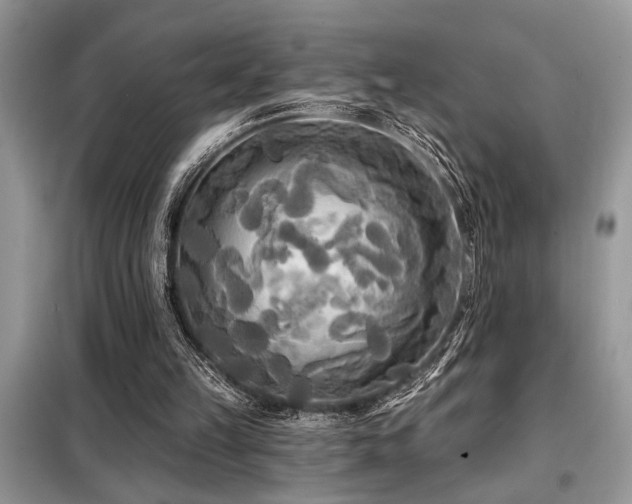 X0000099420149200805091251