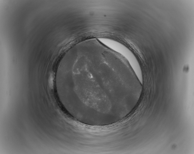 X0000099420026200805161057