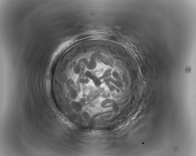 X0000099420149200805161054