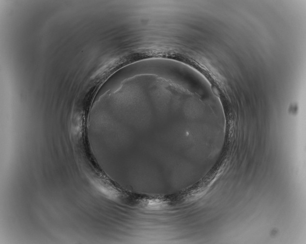 X0000099420165200805161054