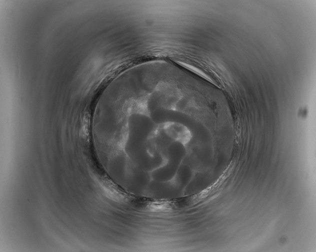X0000099420175200805161054