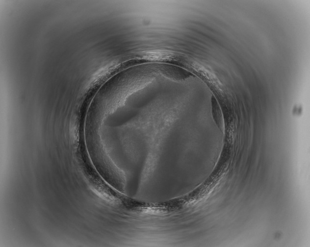 X0000099420303200805161052