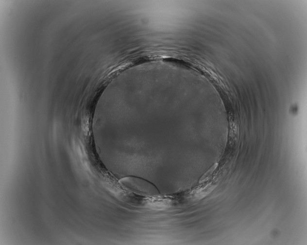 X0000099420331200805161051