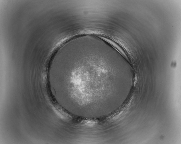 X0000099420352200805161051