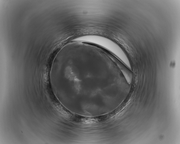 X0000099420359200805161051