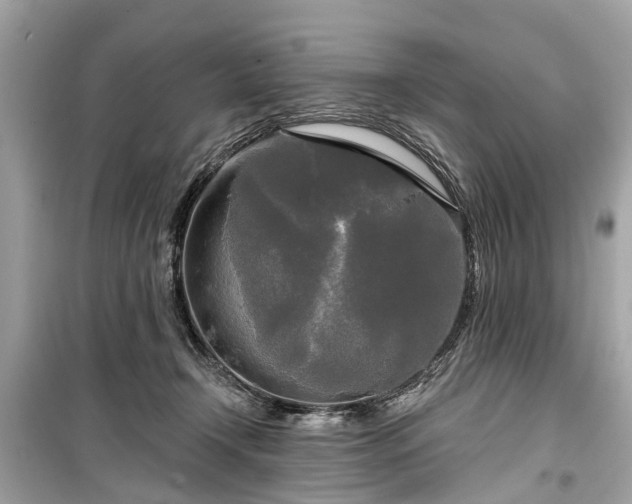 X0000099420366200805161051
