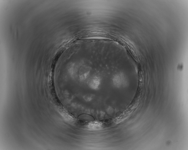X0000099420369200805161051