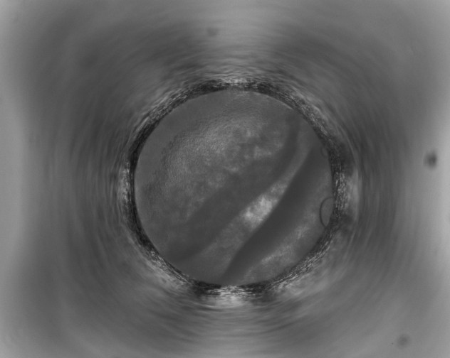 X0000099420612200805161047