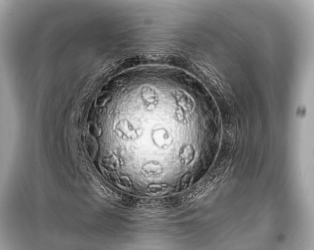 X0000099420817200805161043