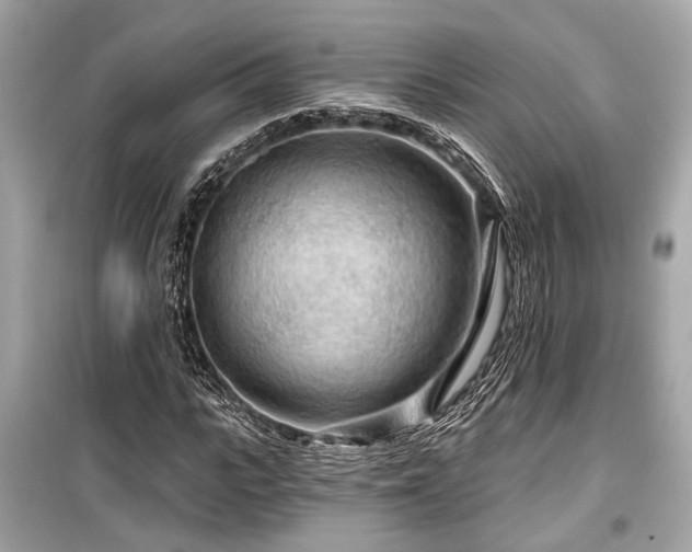 X0000099420919200805161042