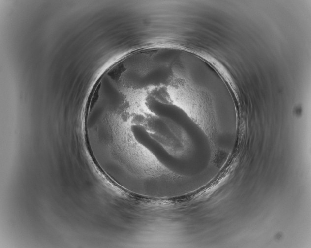 X0000099420957200805161042