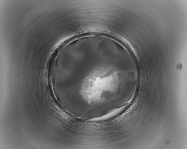 X0000099421019200805161041