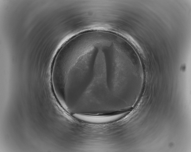 X0000099421240200805161038