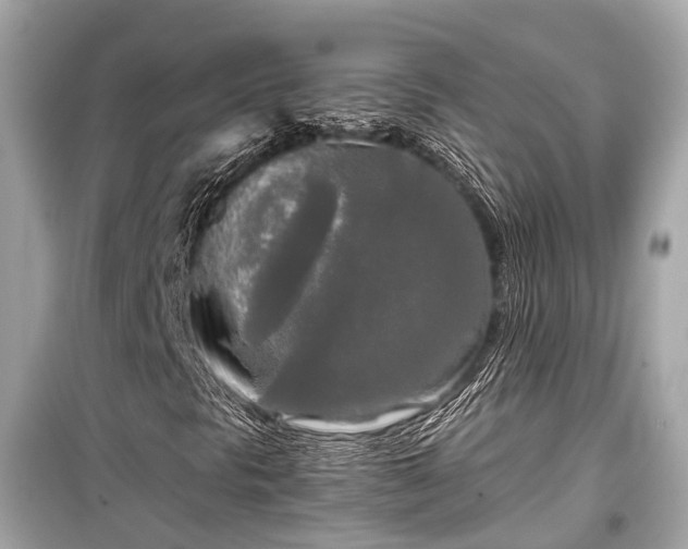 X0000099421297200805161036