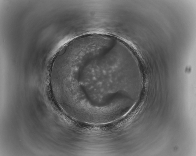 X0000099421359200805161036