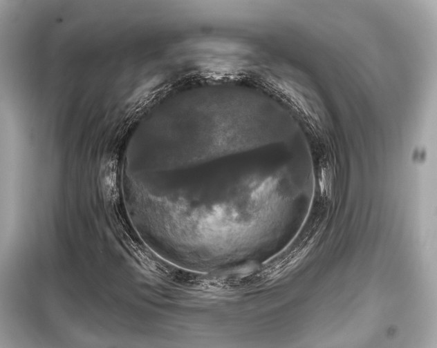 X0000099421396200805161035