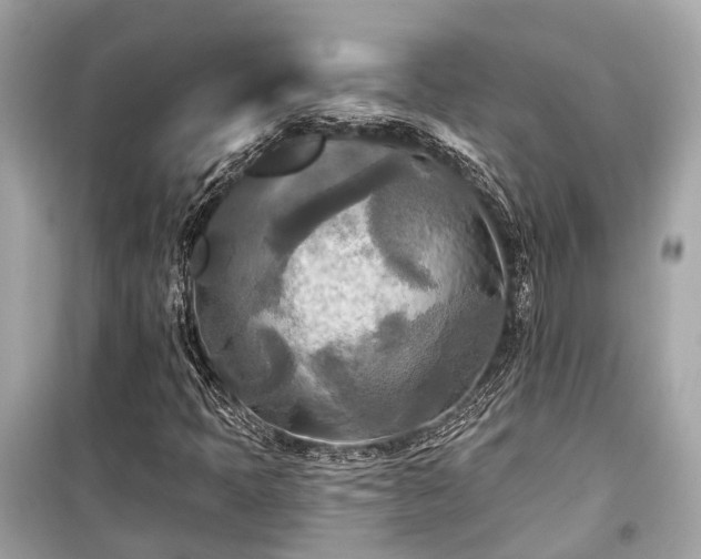 X0000099421397200805161035