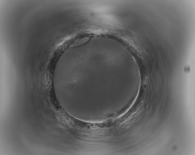 X0000099421398200805161035