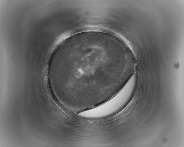 X0000099421411200805161035