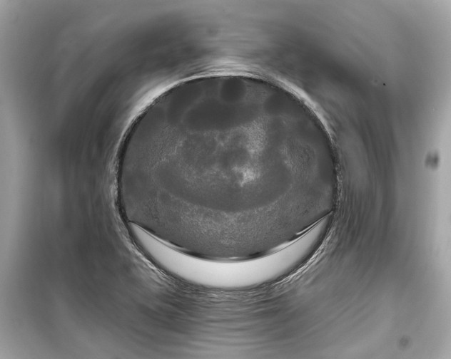 X0000099421415200805161035