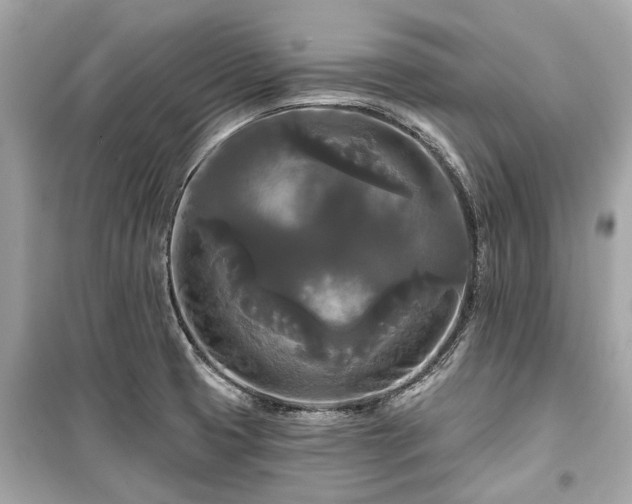 X0000099421425200805161035
