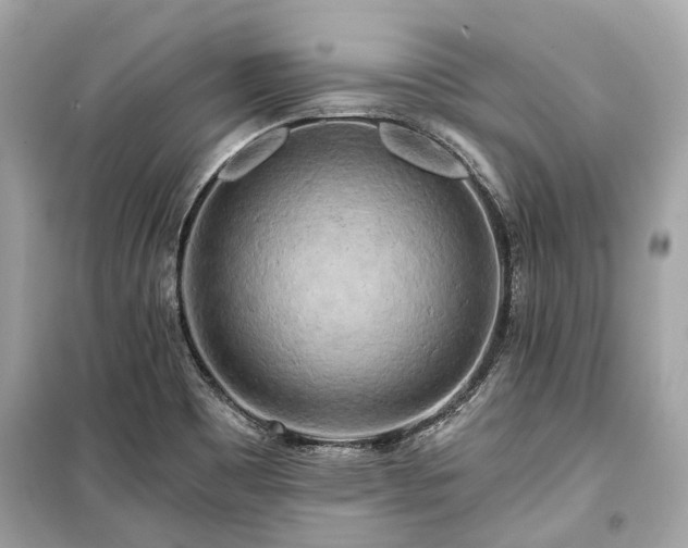 X0000099421465200805161034