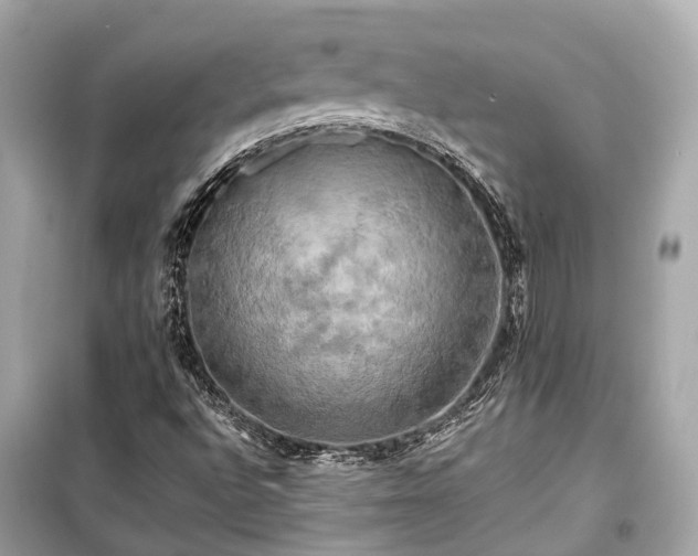 X0000099421496200805161033