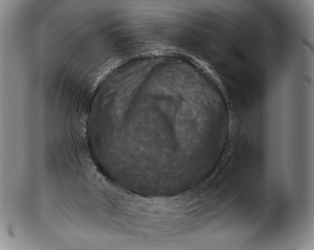X0000099420010200805231640