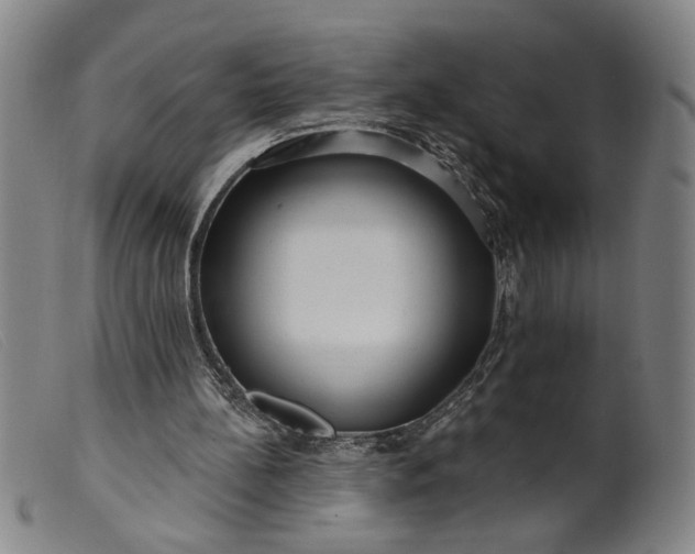 X0000099420148200805231637