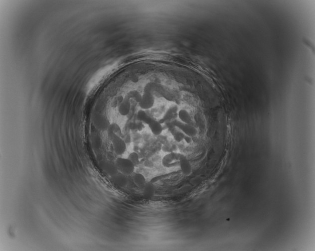 X0000099420149200805231637