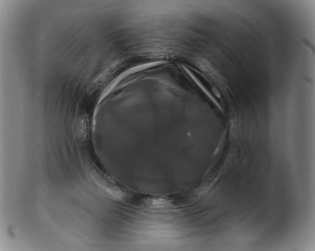 X0000099420165200805231637
